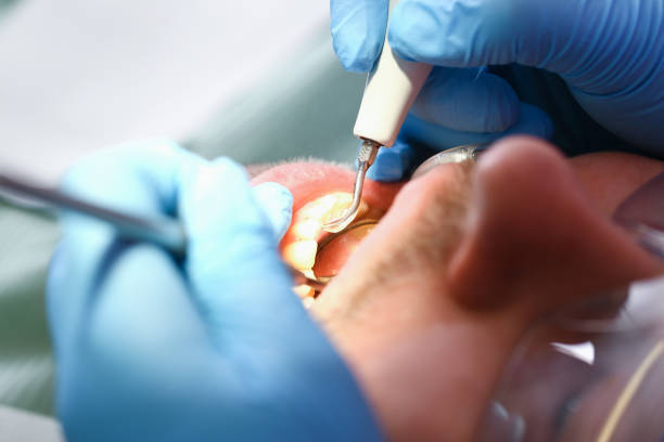 Best Urgent Dental Care for Toothache in Ross, CA