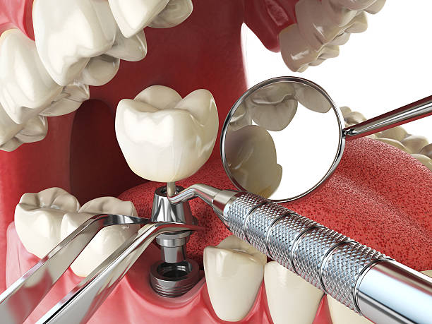 Best Emergency Cosmetic Dentistry in Ross, CA